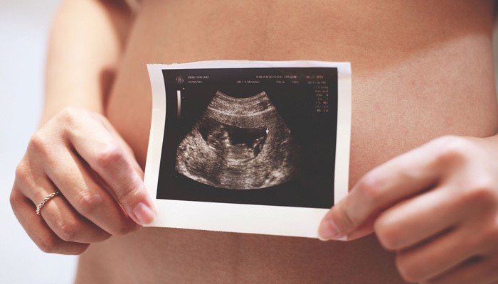Aplicaciones de calendario menstrual 